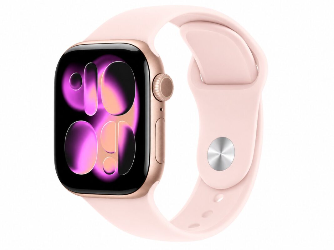 Apple Watch Series 11 (2025) GPS + Cellular 42mm Gold w/ L Pink Band (Refurbished) for 4